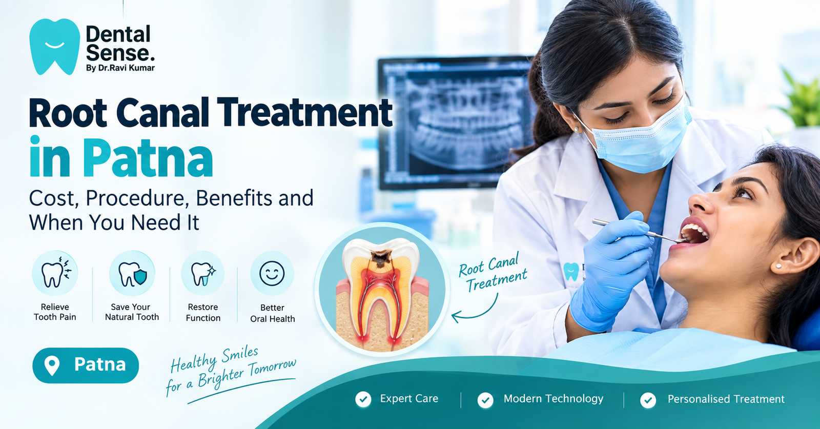 Root Canal Treatment in Patna: Cost, Procedure & Benefits