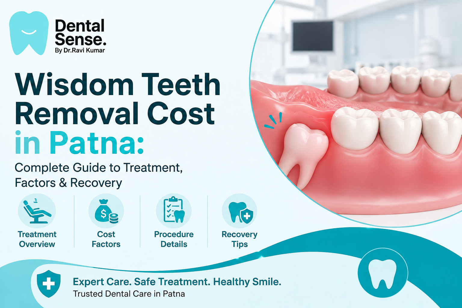 Wisdom Teeth Removal Cost in Patna: Treatment Guide